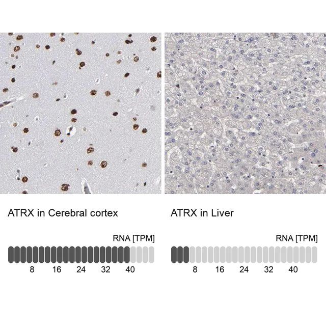 Anti-ATRX antibody produced in rabbit