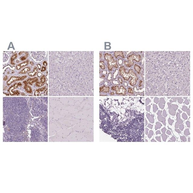 Anti-ATP6V1D antibody produced in rabbit