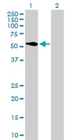 Anti-ATP6V1H antibody produced in mouse