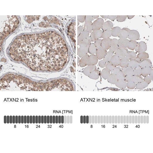 Anti-ATXN2 antibody produced in rabbit