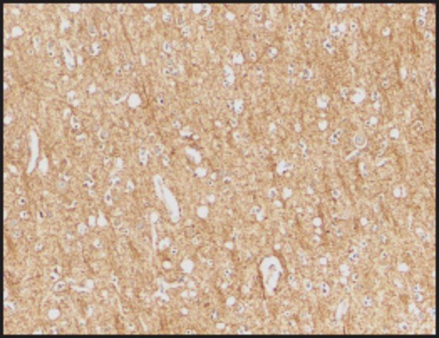 Anti-ATR (ab1) antibody produced in rabbit