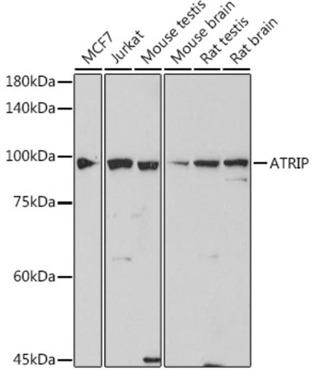 Anti-ATRIP antibody produced in rabbit