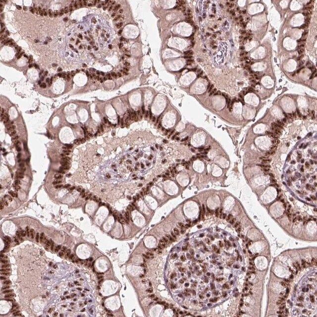 Anti-ATXN7L3 antibody produced in rabbit