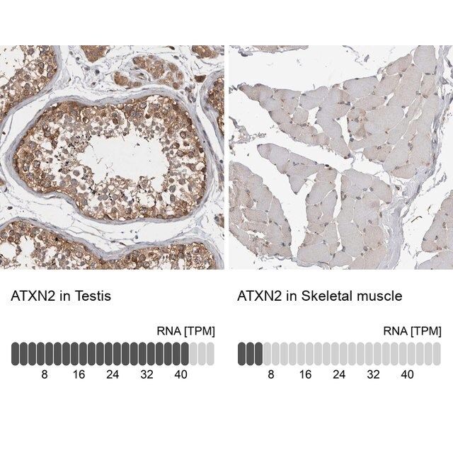 Anti-ATXN2 antibody produced in rabbit