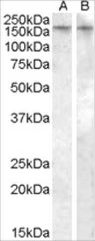 Anti-AVPR1B (AB1) antibody produced in goat