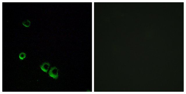 Anti-AVPR2 antibody produced in rabbit