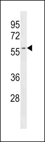 ANTI-AUP1 (C-TERM) antibody produced in rabbit