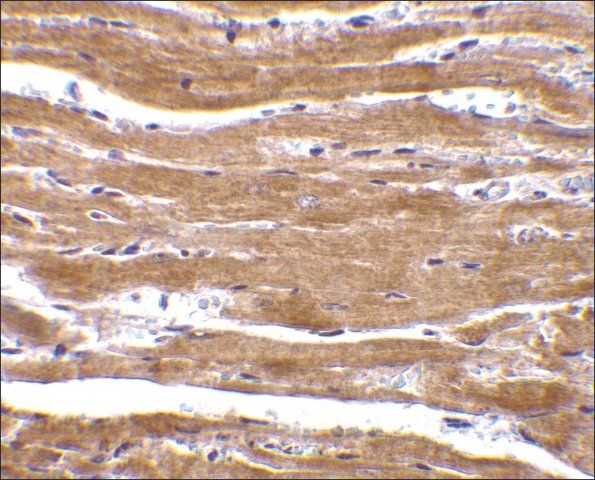 Anti-BACE2 (ab1) antibody produced in rabbit