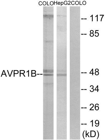 Anti-AVPR1B antibody produced in rabbit