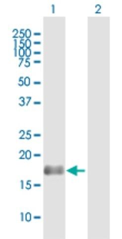 Anti-BAALC antibody produced in mouse