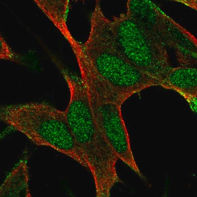 Anti-BAALC antibody produced in rabbit