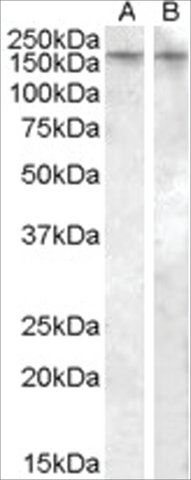 Anti-AVPR1B (AB2) antibody produced in goat