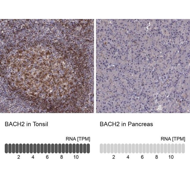 Anti-BACH2 antibody produced in rabbit