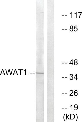 Anti-AWAT1 antibody produced in rabbit