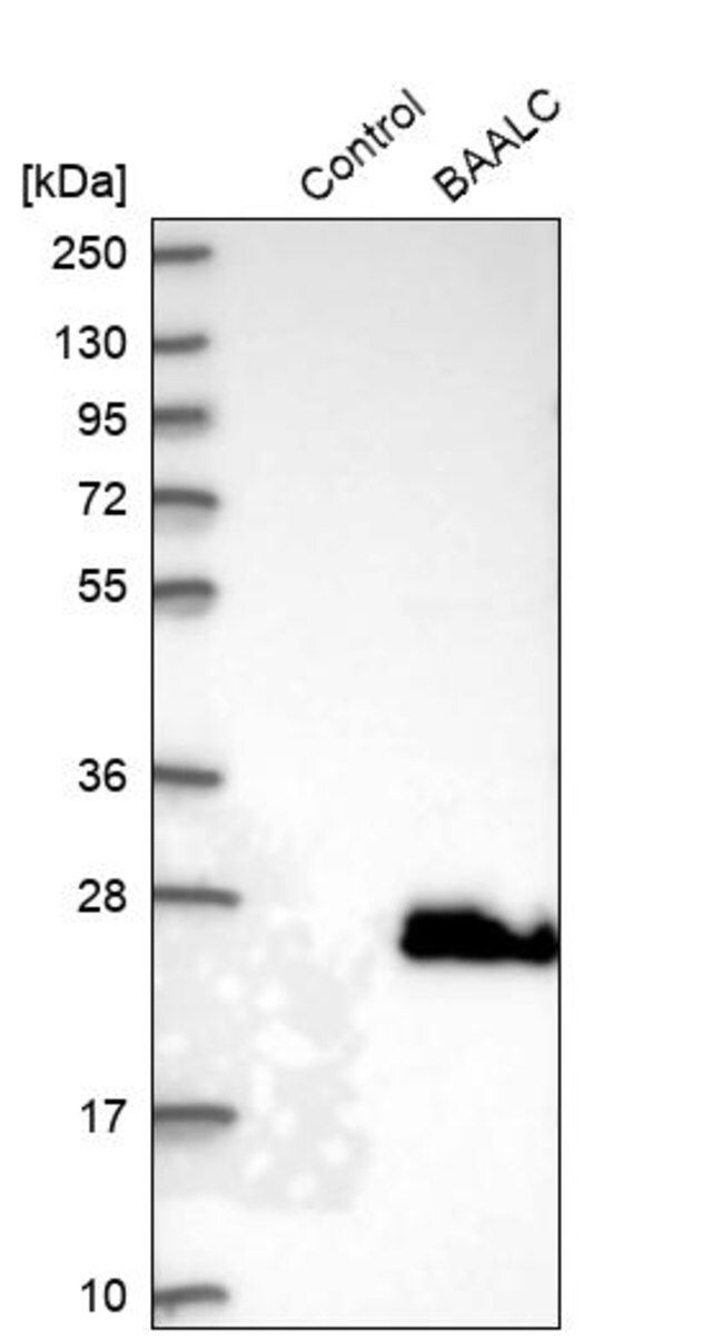 Anti-BAALC antibody produced in rabbit