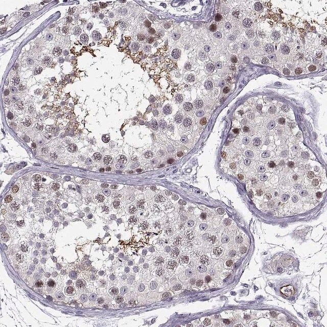 Anti-BACH1 antibody produced in rabbit