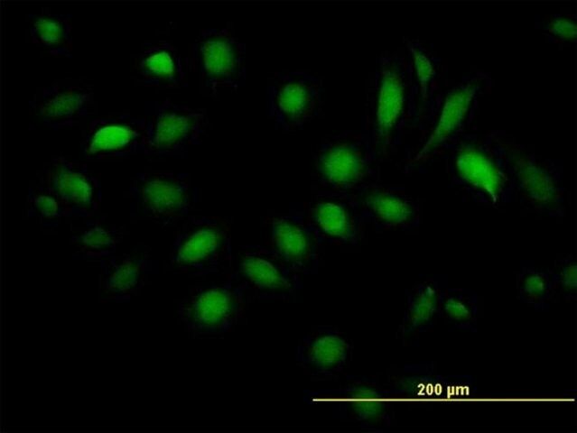 Anti-BAG5 antibody produced in mouse