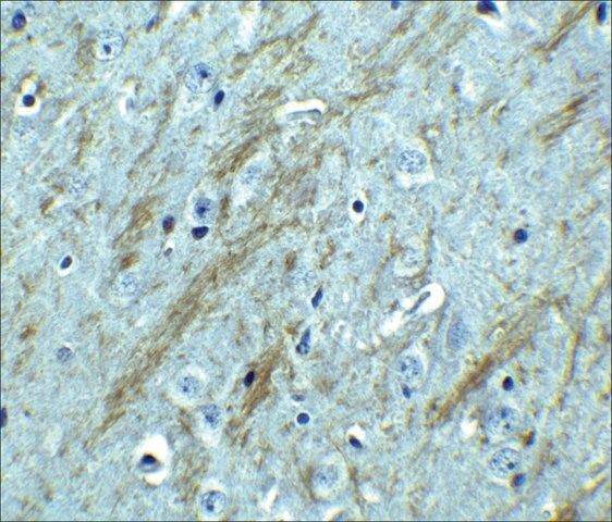 Anti-BACE antibody produced in rabbit