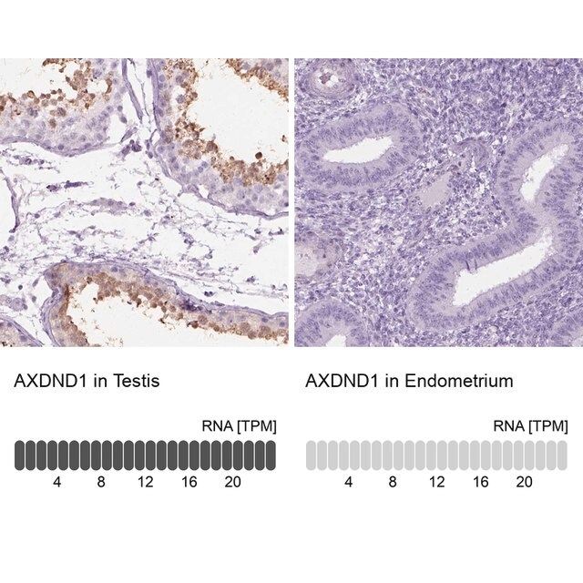 Anti-AXDND1 antibody produced in rabbit