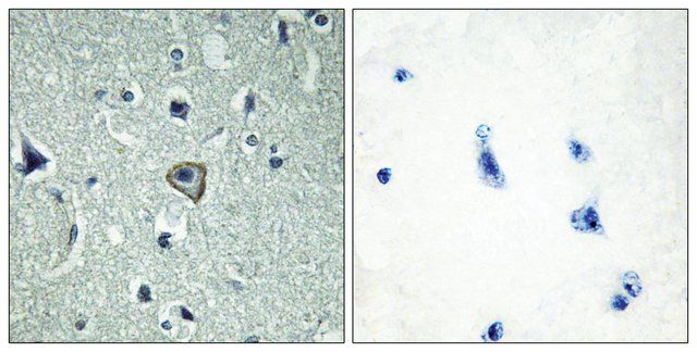 Anti-BAI2 antibody produced in rabbit