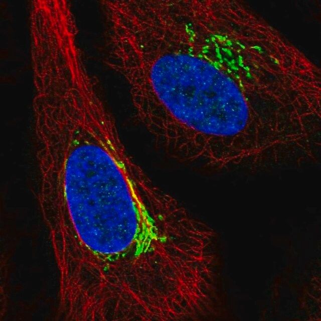 Anti-ARIH1 antibody produced in rabbit