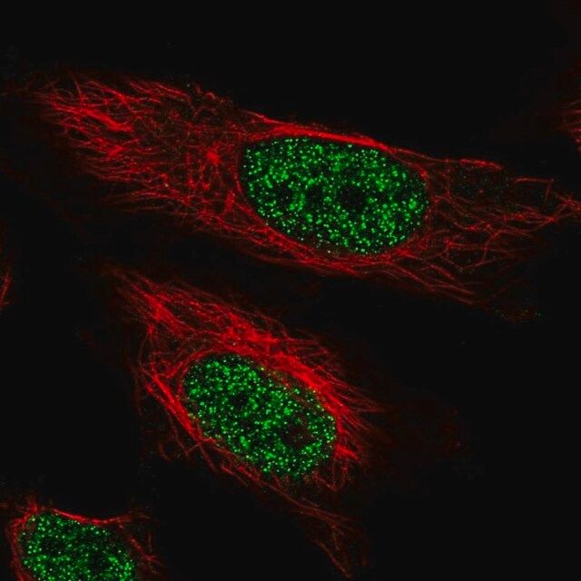 Anti-ARIH2 antibody produced in rabbit