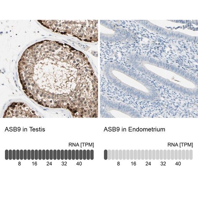 Anti-ASB9 antibody produced in rabbit