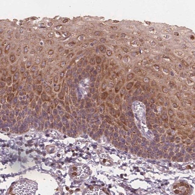 Anti-ASB18 antibody produced in rabbit