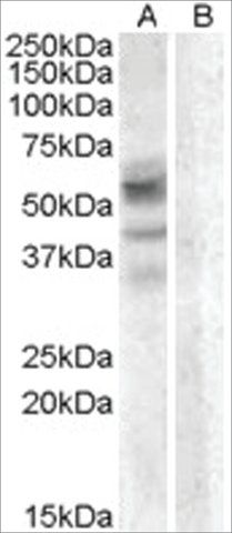 Anti-Arylsulfatase D antibody produced in goat