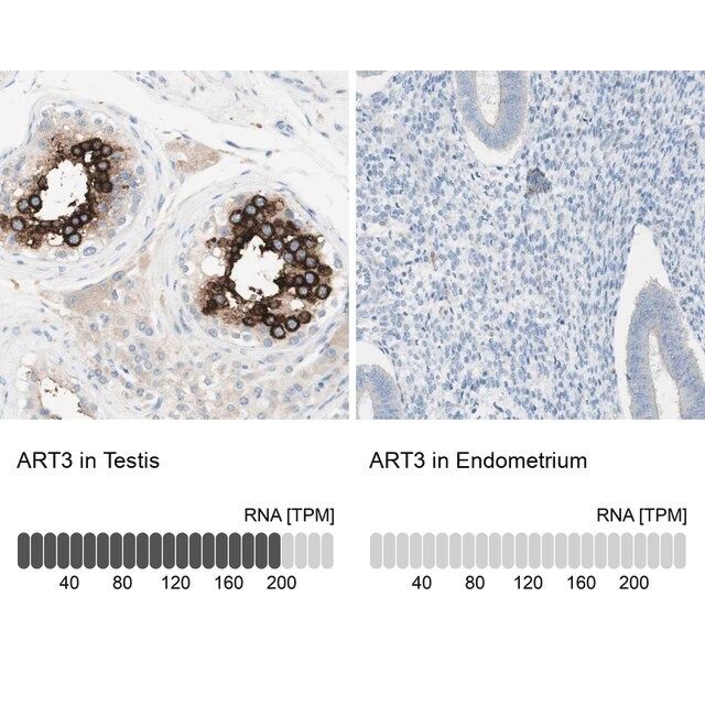 Anti-ART3 antibody produced in rabbit