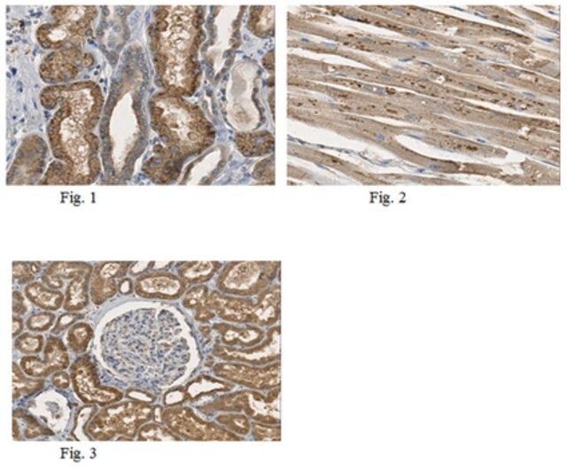 Anti-ASAH1 Antibody