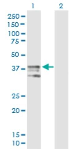 Anti-ART4 antibody produced in mouse