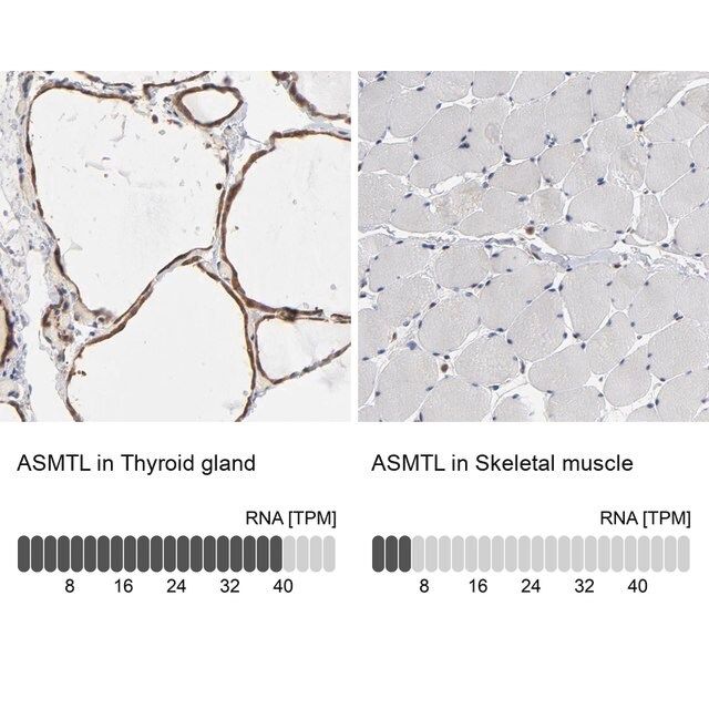 Anti-ASMTL antibody produced in rabbit