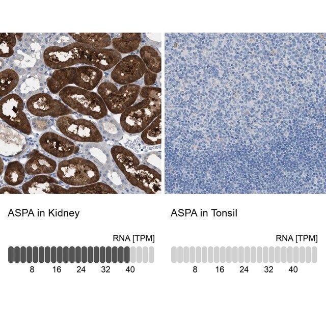 Anti-ASPA antibody produced in rabbit