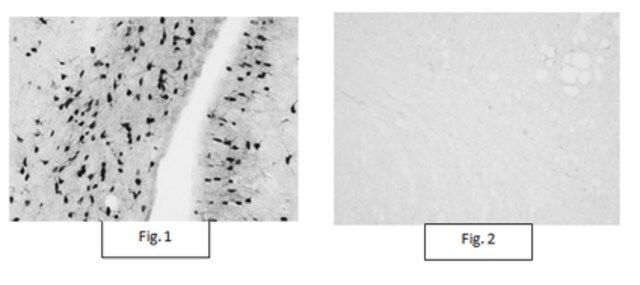 Anti-Aspa/Nur7 Antibody