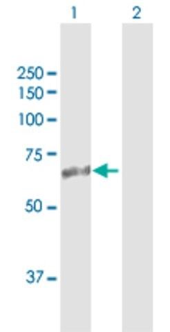 Anti-ASMTL antibody produced in rabbit