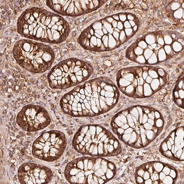 Anti-ASMTL antibody produced in rabbit