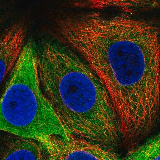 Anti-ASNS antibody produced in rabbit