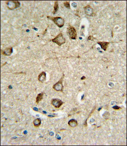 ANTI-ASMT (CENTER) antibody produced in rabbit