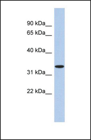 Anti-ASPA, (N-terminal) antibody produced in rabbit