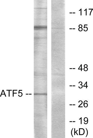 Anti-ATF5 antibody produced in rabbit