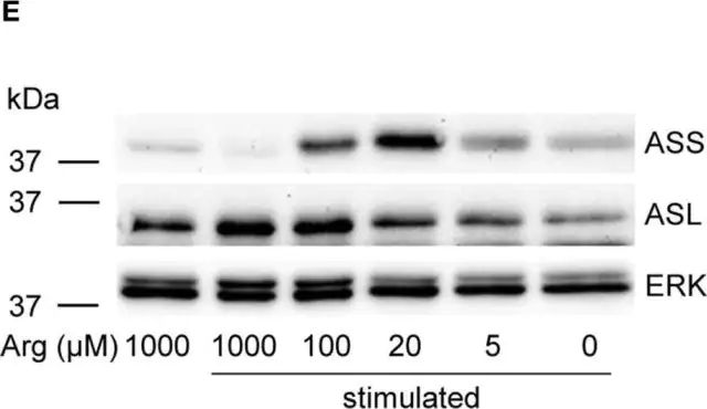 Anti-ASL antibody produced in rabbit