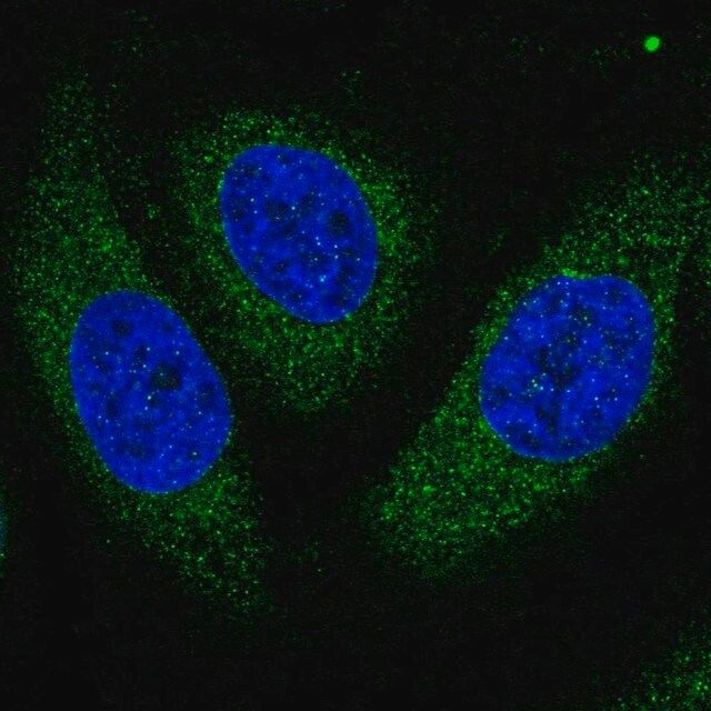 Anti-ASPH antibody produced in rabbit