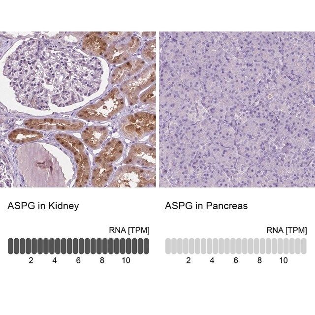 Anti-ASPG antibody produced in rabbit