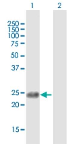 Anti-APOBEC3B antibody produced in mouse