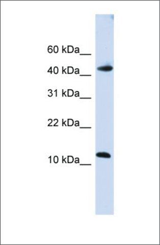 Anti-APOBEC3F antibody produced in rabbit