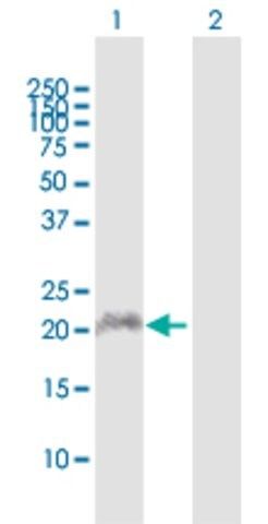 Anti-APOBEC3C antibody produced in rabbit