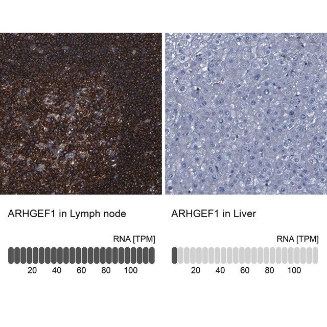 Anti-ARHGEF1 antibody produced in rabbit