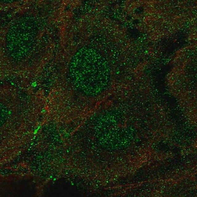 Anti-ARHGEF15 antibody produced in rabbit