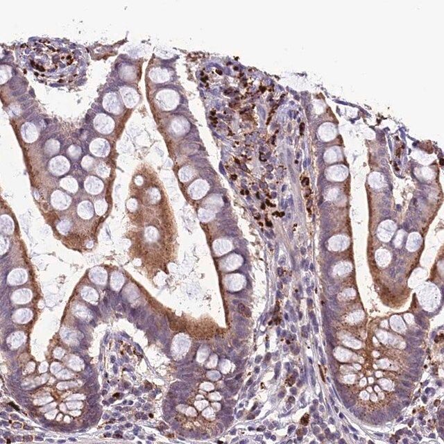 Anti-ARHGEF18 antibody produced in rabbit